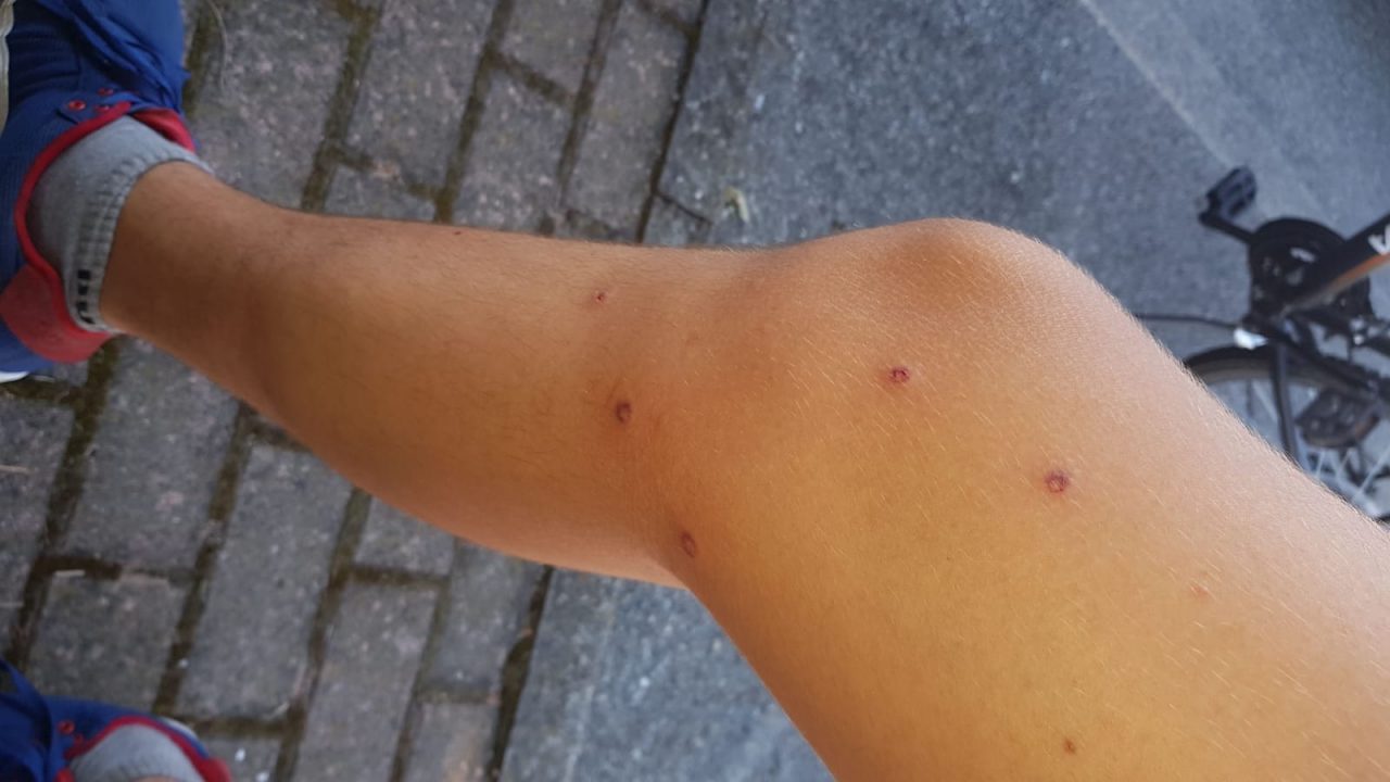 Ragazzino preso a fucilate da due “amici”: undici colpi alle gambe