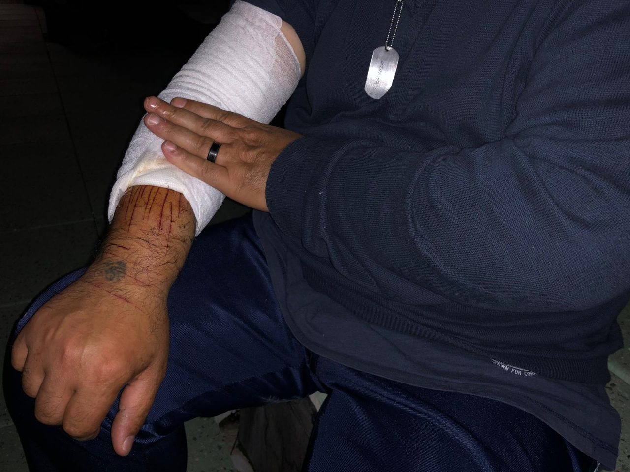 Si squarcia fronte e braccia con una lametta in ospedale