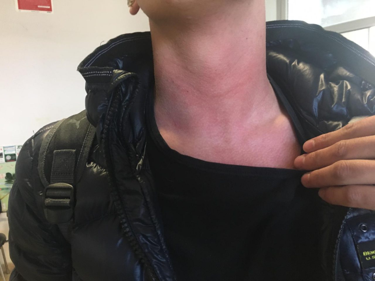 Prof preso a pugni dallo studente, il ragazzo: “Aveva cercato di strangolarmi”