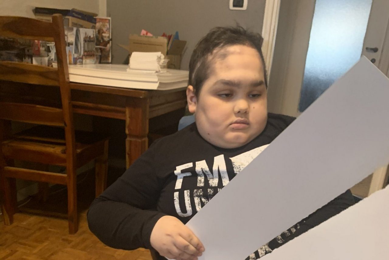 Alessandro, ragazzo speciale che un tumore al cervello ha reso cieco IL VIDEO