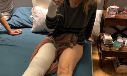 Luciana Littizzetto cade per strada e si rompe rotula e polso