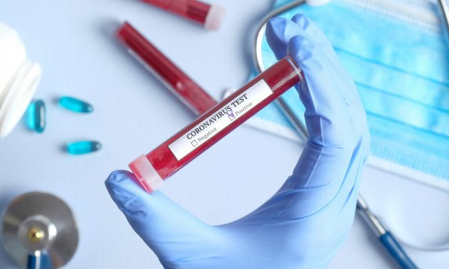 Coronavirus, 10 nuovi decessi in Piemonte