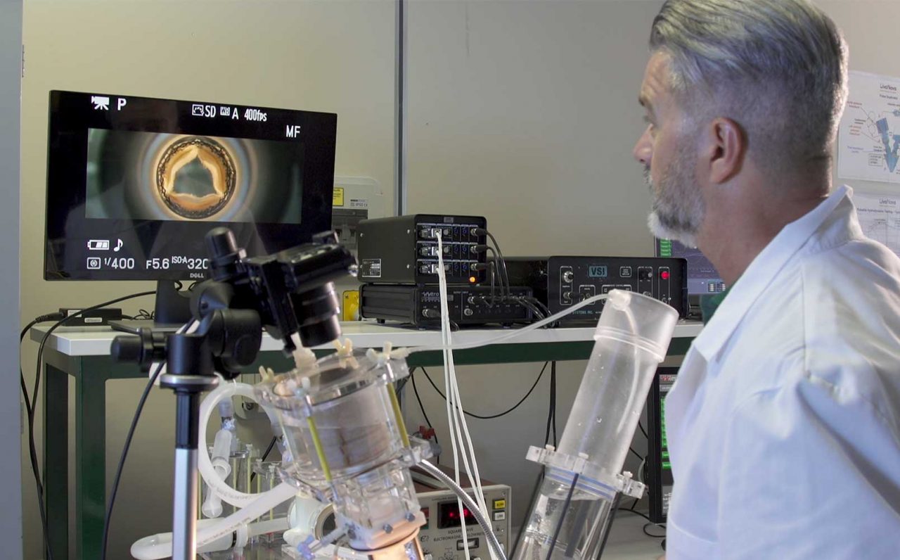 LivaNova ha venduto le valvole cardiache