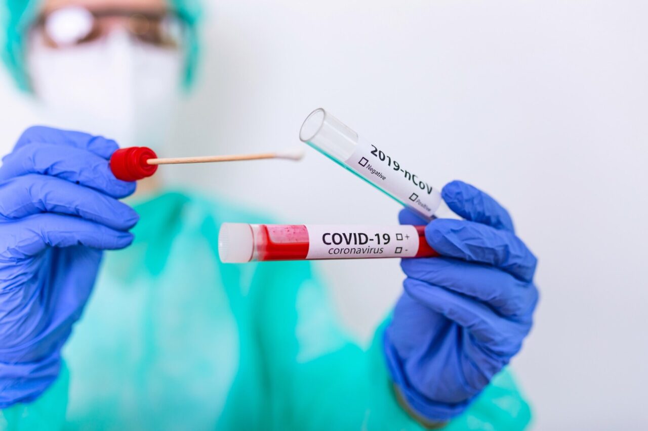 Scoperto falso medico, eseguiva test Covid