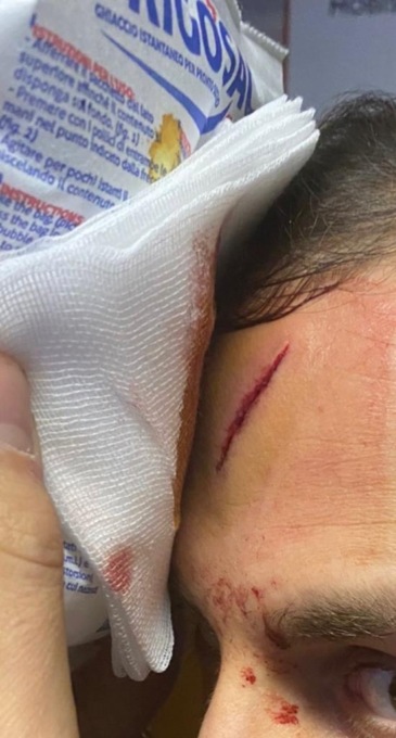 Violenza in carcere: detenuto ferisce un agente con un pentolino