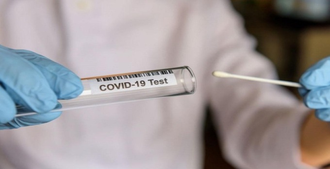 Positivi al Covid, non serve la conferma del test molecolare