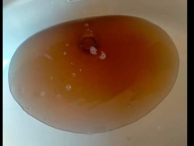 Acqua sporca dai rubinetto, c’è un guasto