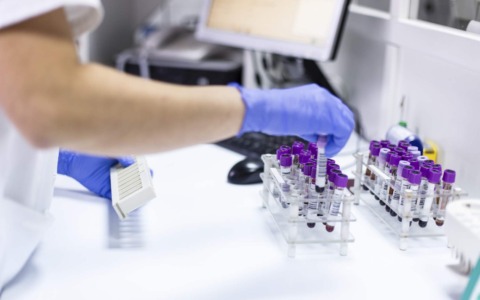 Esami di laboratorio, il sindaco di Chivasso chiede il ripristino degli asterischi