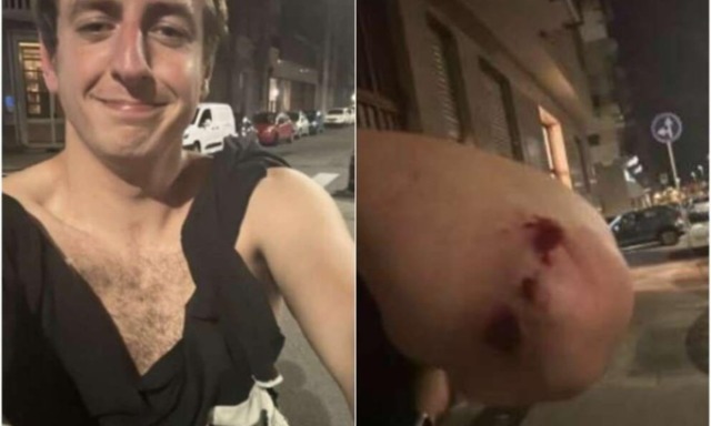 Giornalista aggredito: condannati gli aggressori, risarcimento a Ordine, Fnsi e Subalpina