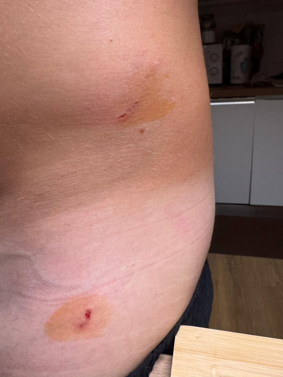 Bull Terrier scappa dal cortile semina il panico tra i passanti: aggredito un uomo